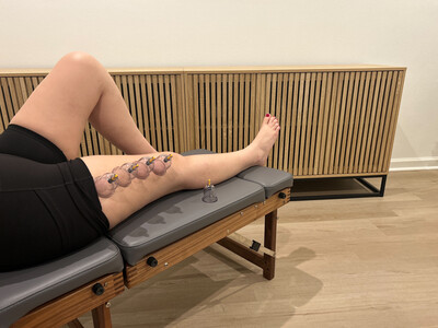 Link to: /pages/cupping-therapy